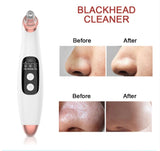 Blackhead Vacuum Extractor USB Rechargeable 6 heads